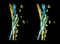 3D Stereoscopy 
