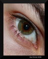 The eye.